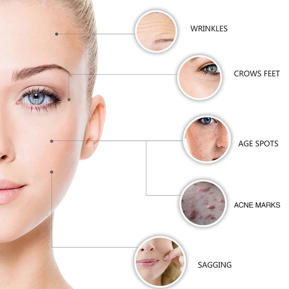 Dermaroller with 10ml Bottle-Hydra Derma Roller Microneedle